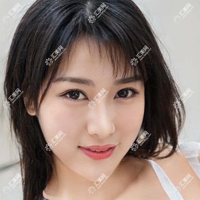 荆州眼鼻整形医生榜单揭晓!郭莉、李杰以精细技艺受推崇!
