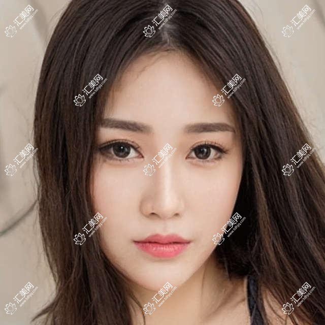 乌鲁木齐医生排行揭秘!眼部鼻部微雕医生,技术精细备受赞誉!