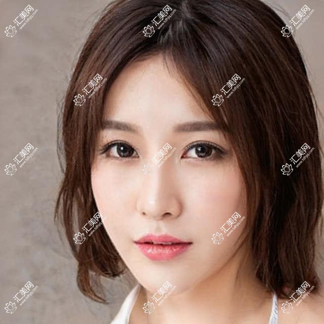 包头地区眼部整形医生推荐,揭秘多位名医精细技艺