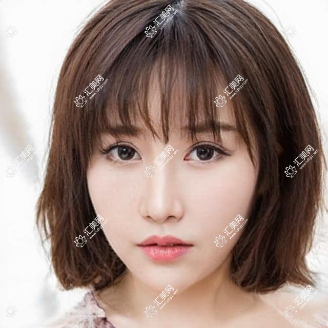 成都优选近视手术眼科医生盘点！实力备受好评！