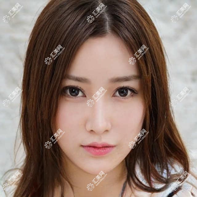 柳州牙齿矫正医生排行出炉!黄桂平、胡庆安、和黄宝技术获赞!