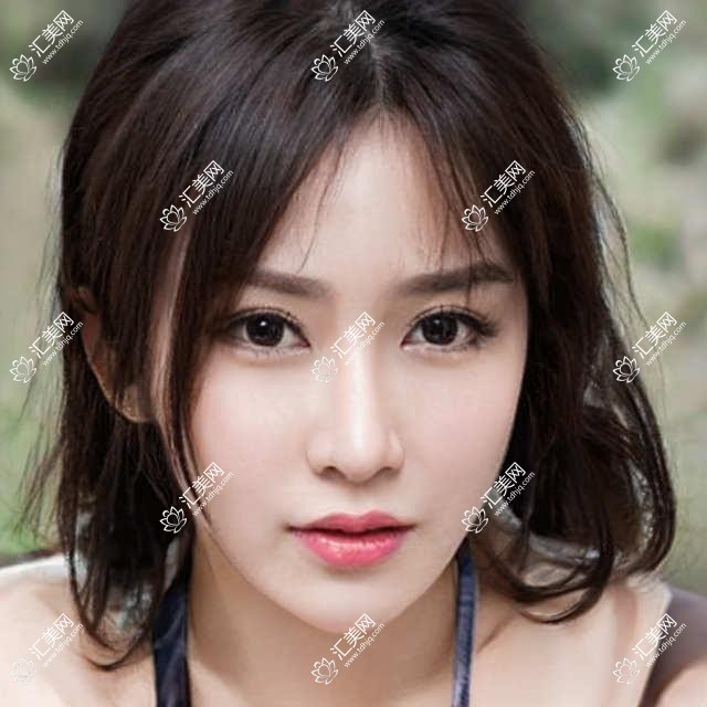 汕头突出眼科医生盘点:白内障近视手术受网友热捧!医生推荐新版!
