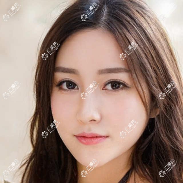 荆州眼科医生推荐：王海波陈莹精通眼部晶体植入与近视矫正