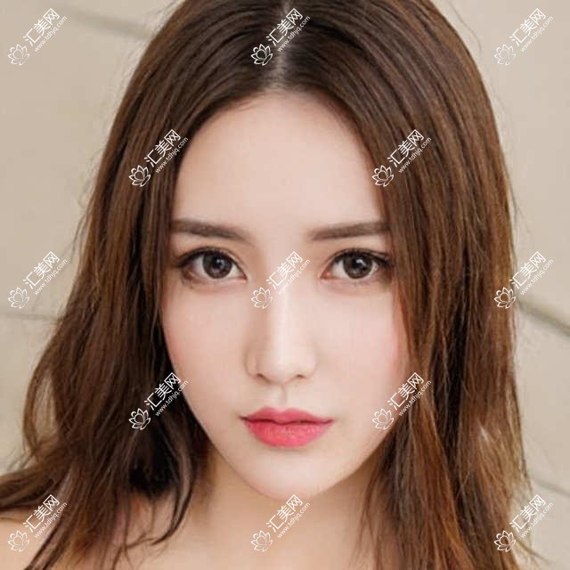 北京亿阳口腔项目价目表揭晓 单颗种植牙3980起!