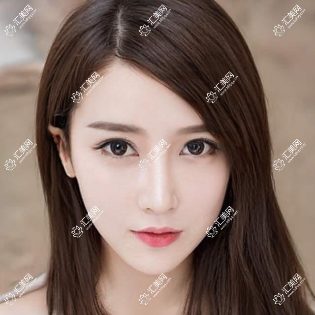 武汉何氏眼科价格揭秘:近视激光、白内障手术等眼科项目费用一览