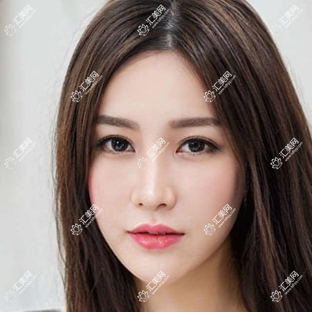 成都军建疤痕科医美价格揭秘:祛疤、嫩肤、紧肤项目费用一览