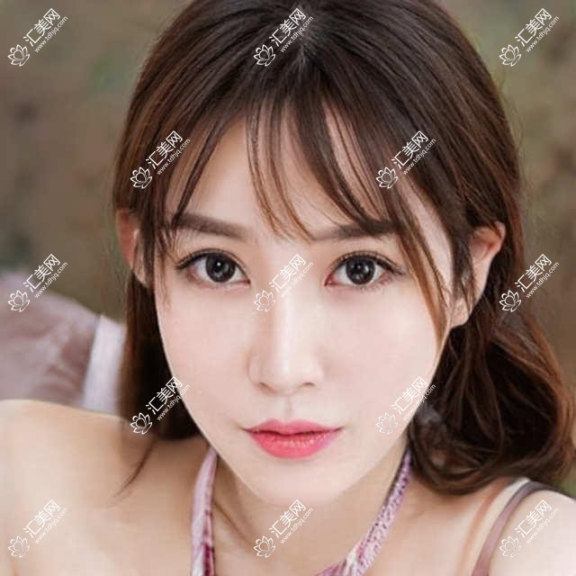 惠州眼科医生推荐!苏华、王丁丁、毕伍牧等名医眼部诊疗技术精细,口碑优良!