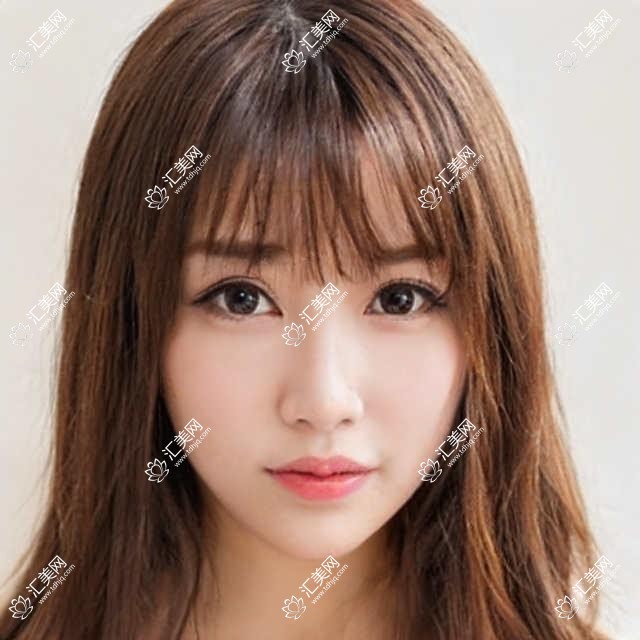 上海瑞东眼科全项目价格揭秘：近视激光、白内障手术等热门医美费用一览