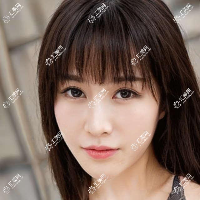 广州市张剑民口腔诊所贴面价格揭秘?牙齿美白3K+ 矫正1W+ 种植牙8K+