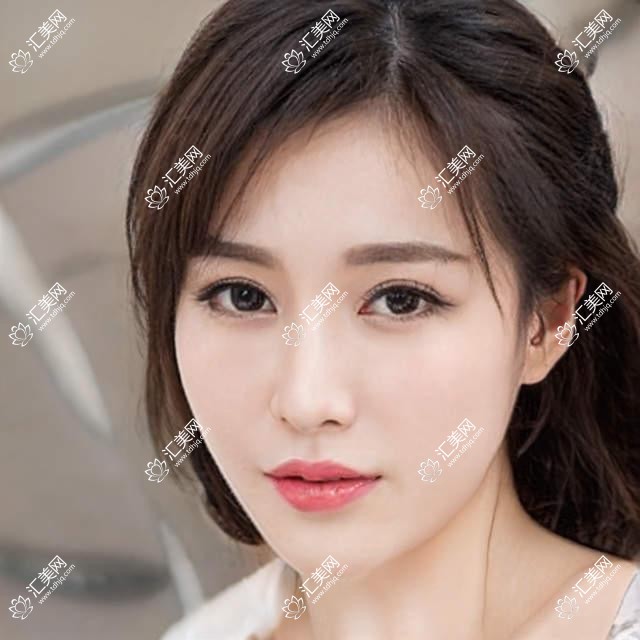成都华厦眼科全项目价格揭秘：近视激光、白内障手术等热门医美一览