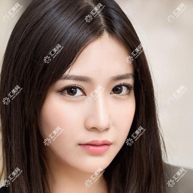 泰州擅长眼科手术的医生有哪些？梅建忠与张勤等医生备受推崇