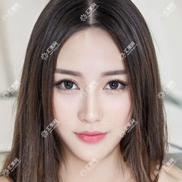 天津长庚眼科全项目价格揭秘:近视矫正、白内障手术等热门医美一览