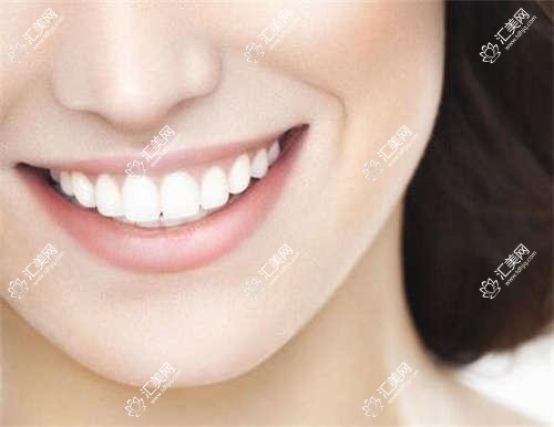 武汉市湖北武汉达尔文口腔牙齿矫正种植价格揭秘：隐形矫正2W+ 种植牙1W+/颗 牙齿美白3K+
