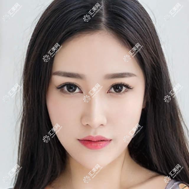 成都睛彩眼科全项目价格揭秘:近视矫正、白内障手术性价比如何?