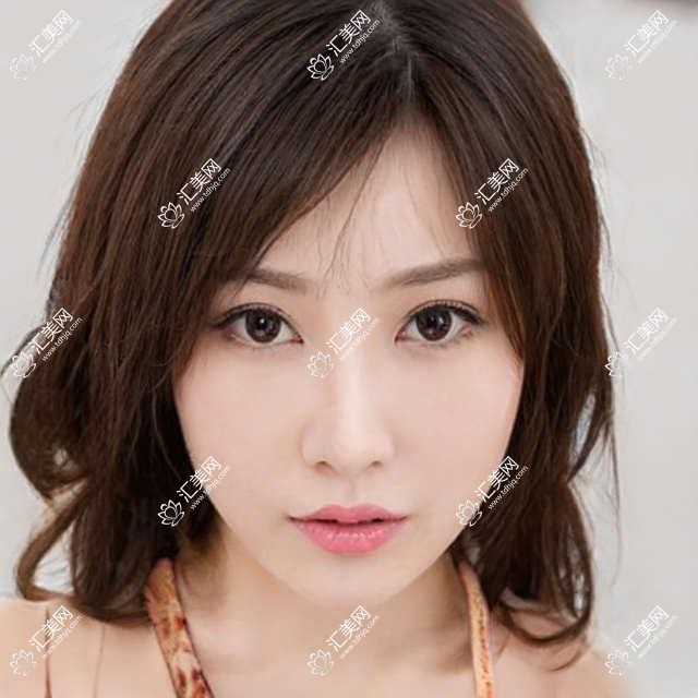 深圳爱尔眼科医生徐进秦波及尹海泉,近视手术及角膜屈光矫正如何选?