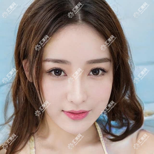 吉林眼科医生擅长白内障及近视手术,技术精细,好评如潮,速来了解!