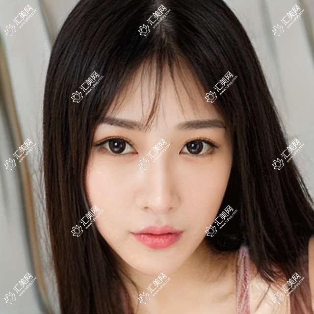 广州佰视佳眼科项目价格大全,从基础到多面深度剖析,费用12800元起