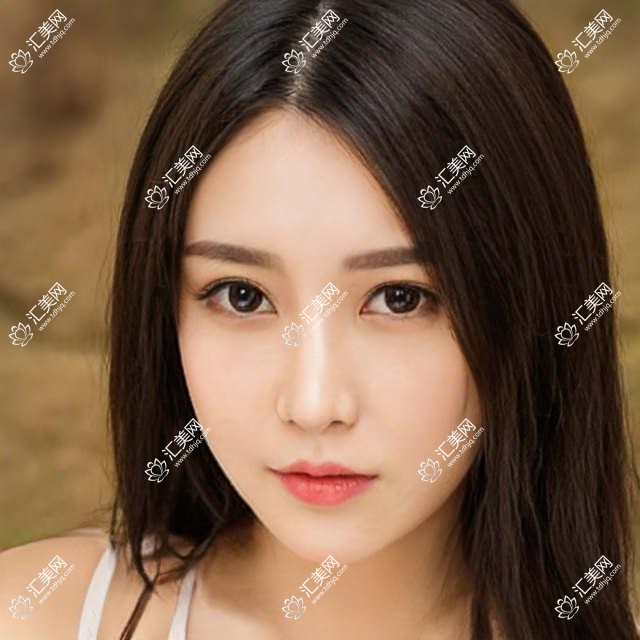 北京市宁联西海眼科视力矫正价格揭秘:全飞秒近视手术近2W,ICL晶体植入3W起,还有更多优惠等你来!