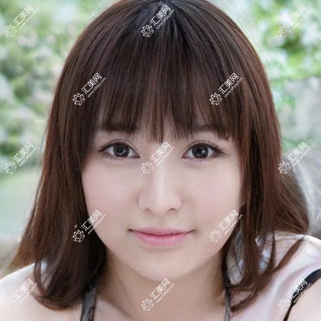 深圳卫尔斯眼科项目价格揭晓!近视矫正8800起!