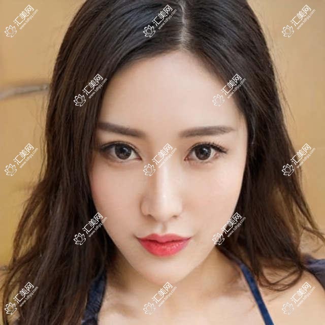 成都华厦眼科项目价格一览:白内障手术+多项眼科治疗费用详询