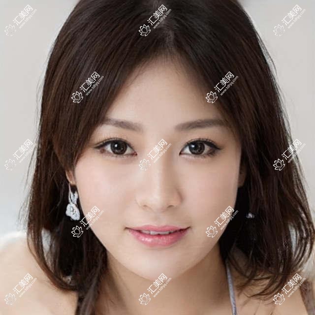杭州近视手术医生推荐,内含擅长全飞秒医生信息