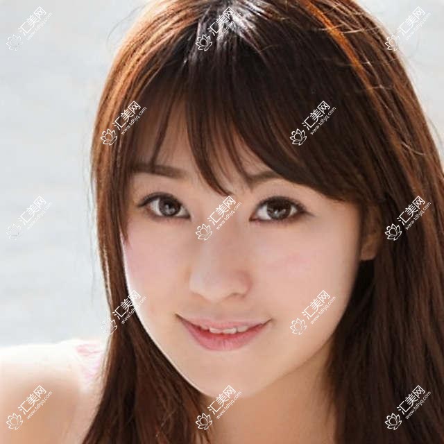 武汉美莱医美口腔全项目价格表:开眼角至鼻综合2999+