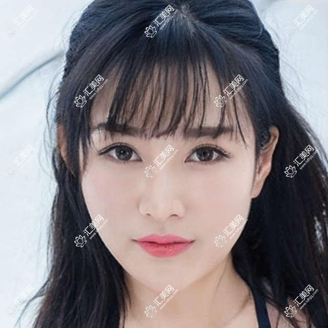 吉林国健口腔梁柱烈金炫成权花淑医生牙齿矫正修复如何?还有哪些医生擅长隐形及咬合调整?