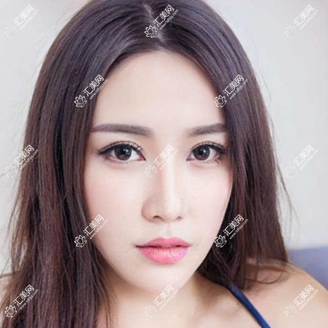北京市爱尔福康眼科治障费用揭秘？白内障手术2W+/近视激光1.5W+/老花眼矫正3W+