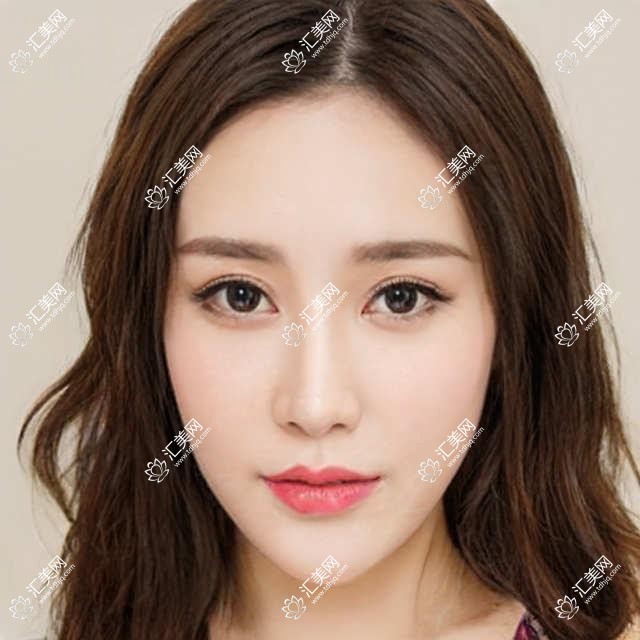 深圳爱尔眼科全项目价格表:近视半飞秒
