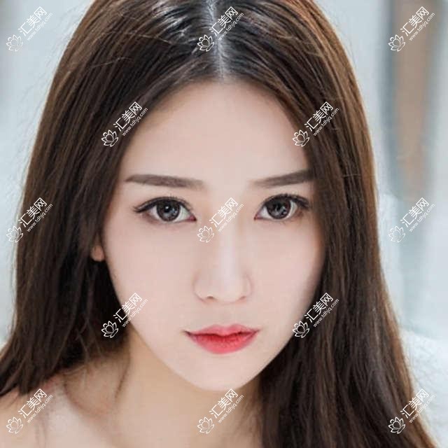 包头有名医生眼部整形排行榜(含特色项目+费用)_眼部美化优选