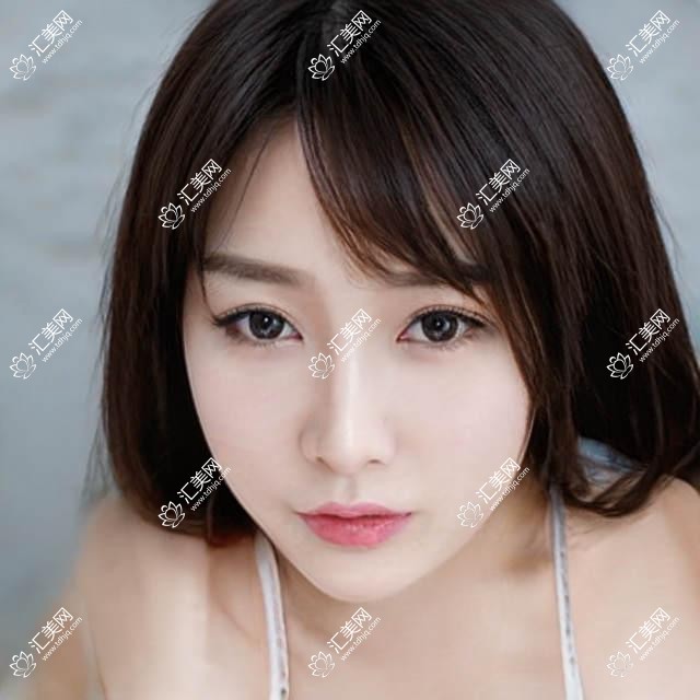 广州杨医微创祛痘敏感修复价目表:祛痘980+敏感修复1680+性价比高