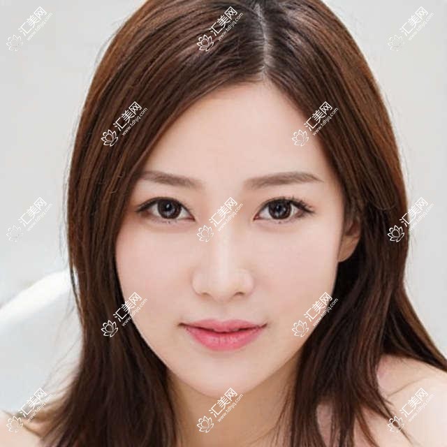 洛阳地区口腔种植医生邱承林、郑淑敏、谢良雄如何？全口即刻种植技术有何优势？