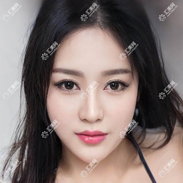 天津华厦眼科揭秘:热门眼科项目价格大公开,近视激光&白内障手术都在列!