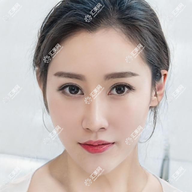 三亚眼科医生张晓琴领衔,精通全飞秒近视手术,技术精细,好评如潮!