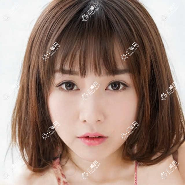 上海威沃眼科价格揭秘:近视手术、白内障治疗等热门项目一览