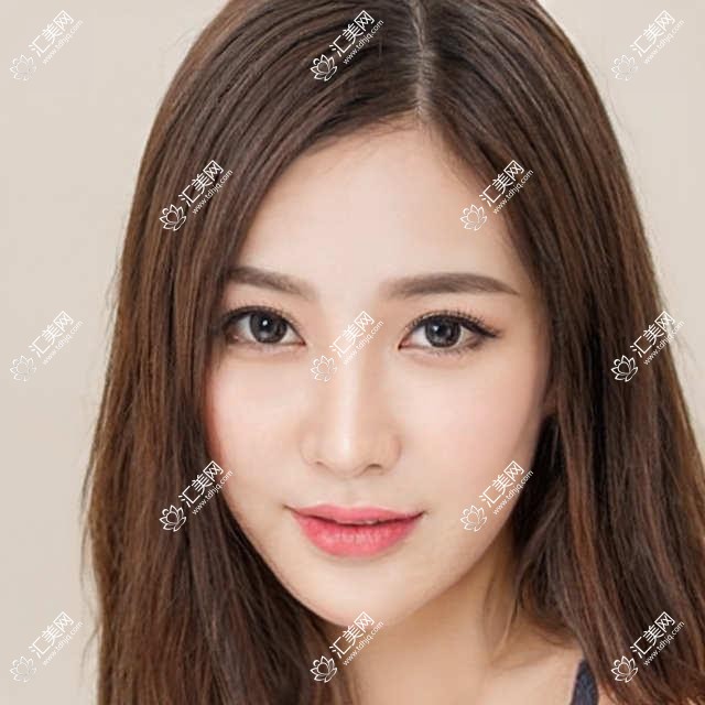绍兴地区眼科医生推荐:梁丽琼与赵炳坤详解近视及白内障手术方案