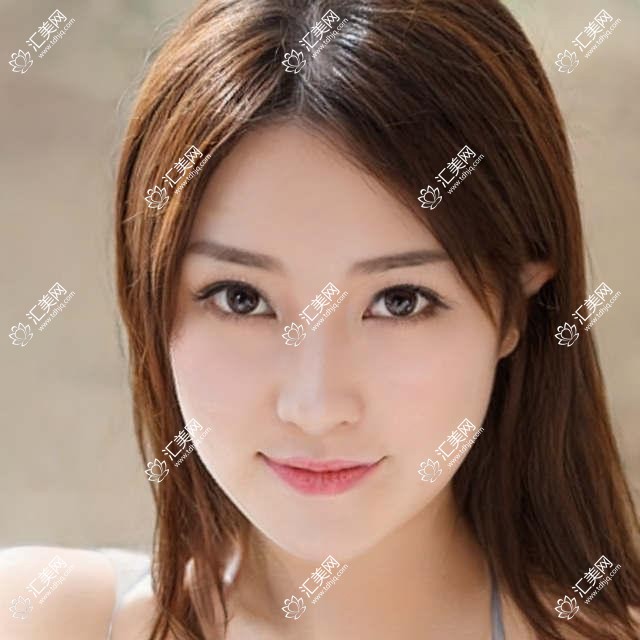 淮安近视手术优选医生有哪些?淮安爱尔眼科陈绪攀医生备受推荐
