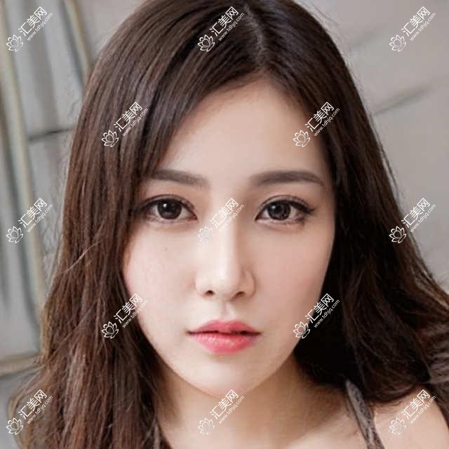 沈阳眼部整形医生榜单揭晓!边玉印、董红星、王松技术获赞!