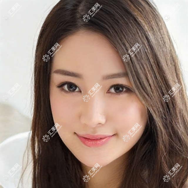 广州华厦眼科项目价格一览:近视激光