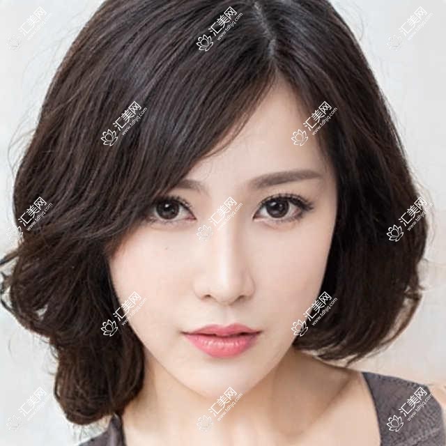 昆明擅长眼科治疗医生有哪些?王慧杨槐袁援生等医生榜上有名