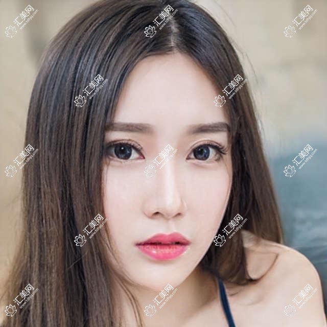 佛山口碑优选牙齿矫正医生盘点!时代天使隐形矫正受好评!