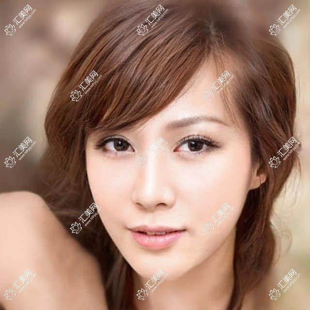 成都青羊萌鹰眼科项目价格全览:从基础到特色多面剖析,费用12800元起