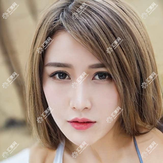 呼和浩特面部微整医生推荐:吴鹏、白莉医生备受好评