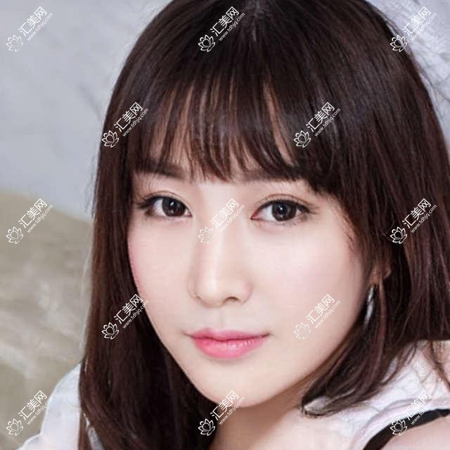 上海星晨眼科全项目价格揭秘:近视激光、白内障手术等热门医美一览