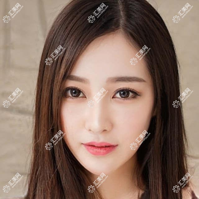 上海黑马眼科项目价格大揭秘：全览清晰 单项低至1800起！