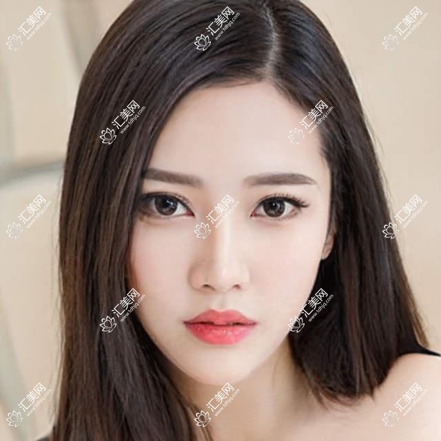 周口隆鼻优选医生：孟庆鹏、张弘业、李士成精细鼻整形受好评