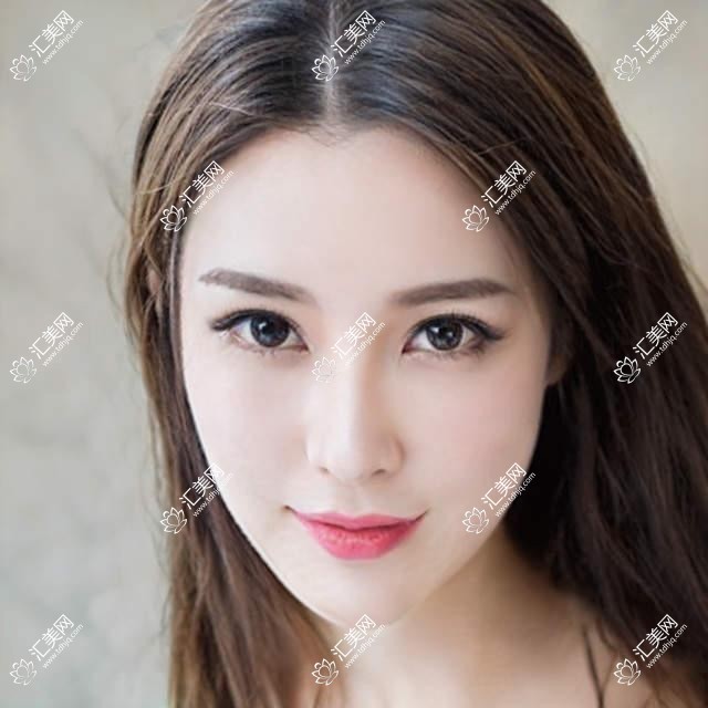 北京希玛眼科价格揭秘：近视手术8000+白内障6000+检查套餐200元起实惠公开