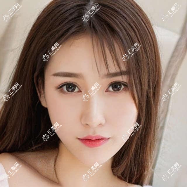 江门近视手术医生赵春阳，精通全飞秒、准分子激光手术，打造清晰视界