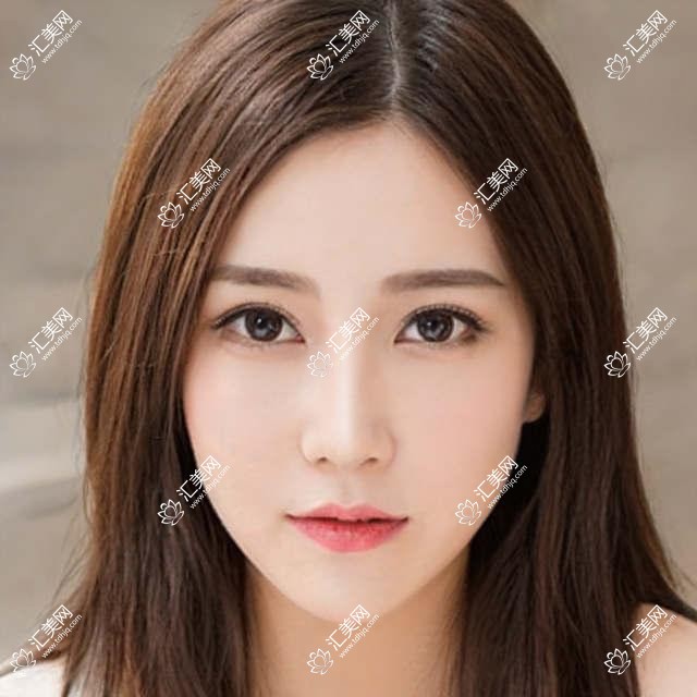 北京熙仁眼科项目价格揭秘：白内障超声乳化6000元起，麻痹斜视矫正1万起，半飞秒激光1.8万起