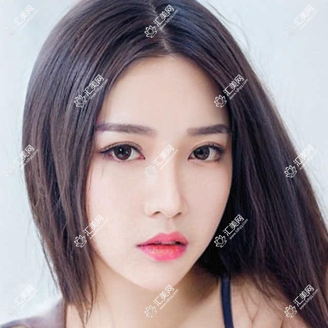 枣庄地区精选眼科及整形医生推荐，擅长青光眼白内障及面部微雕